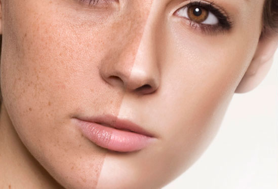 beauty retouch cma