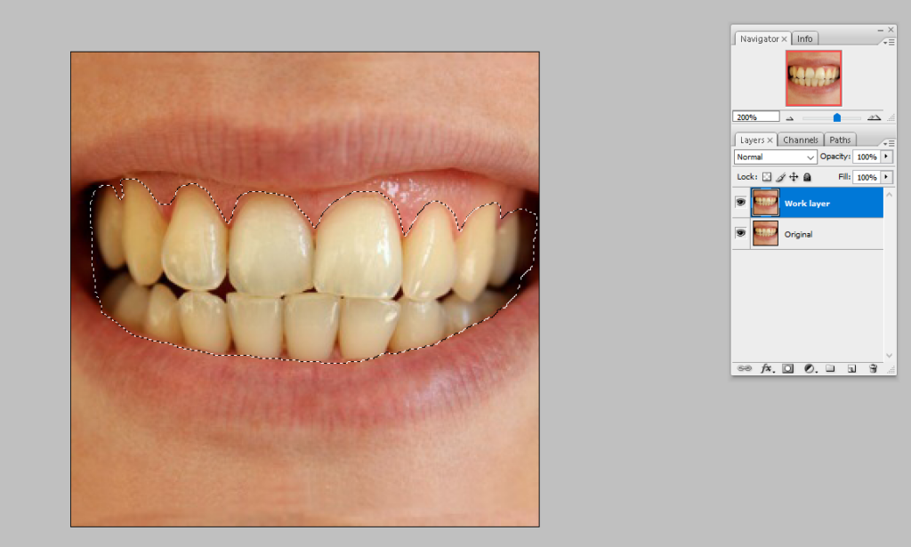 Step two how to whiten teeth in photoshop